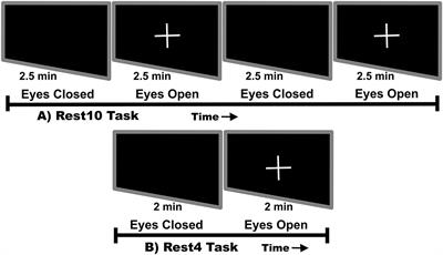 Test–Retest Reliability of Magnetoencephalography Resting-State Functional Connectivity in Schizophrenia